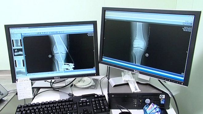 Quarter of radiologist posts in Northern Ireland vacant